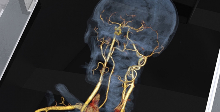 Photo of Interventional Neuroradiology