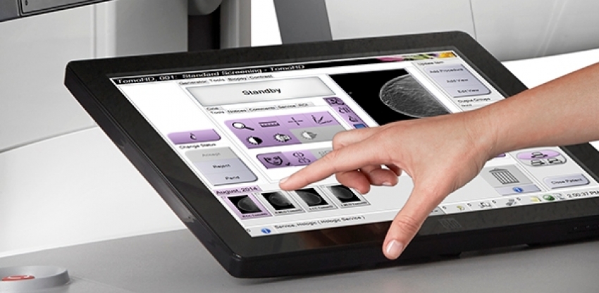 Photo of Mammography